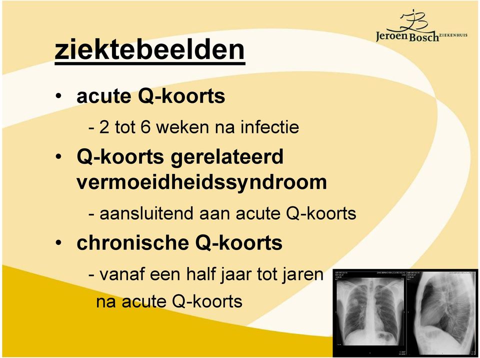 vermoeidheidssyndroom - aansluitend aan acute