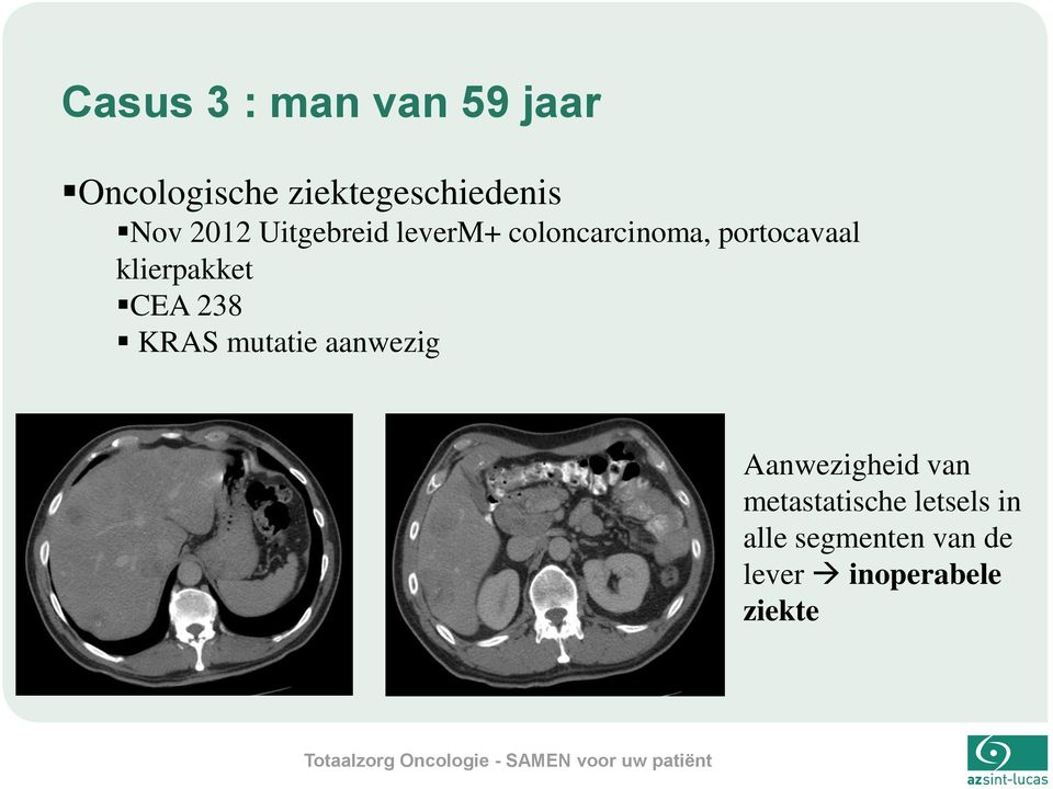 klierpakket CEA 238 KRAS mutatie aanwezig Aanwezigheid van