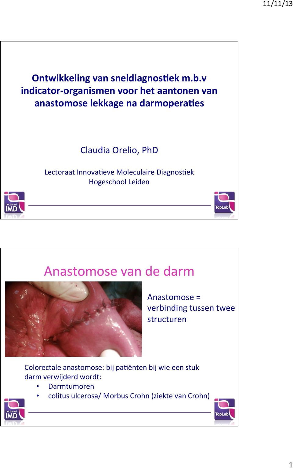 Lectoraat Innova9eve Moleculaire Diagnos9ek Hogeschool Leiden Anastomose van de darm Anastomose =