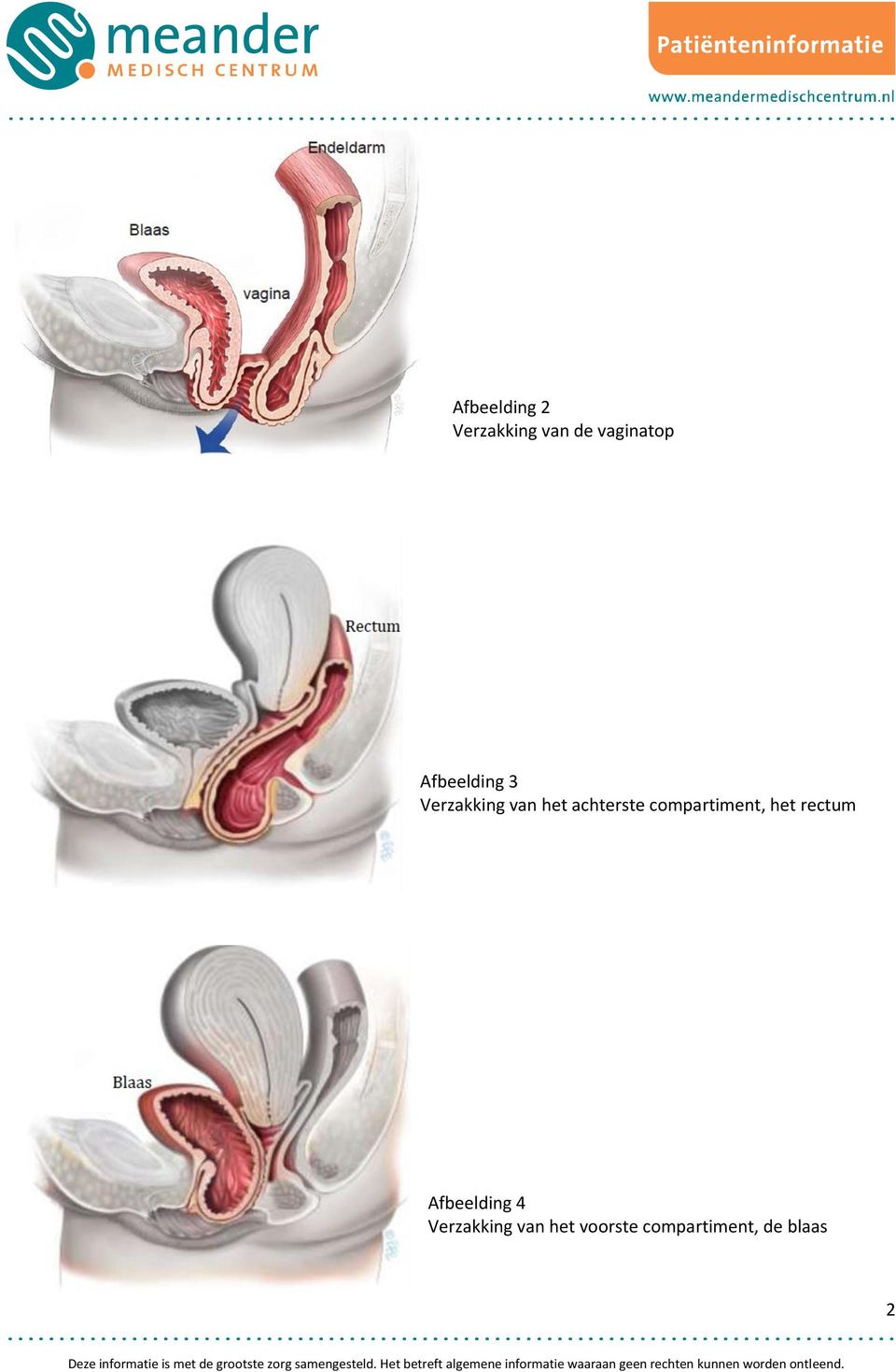 compartiment, het rectum Afbeelding 4