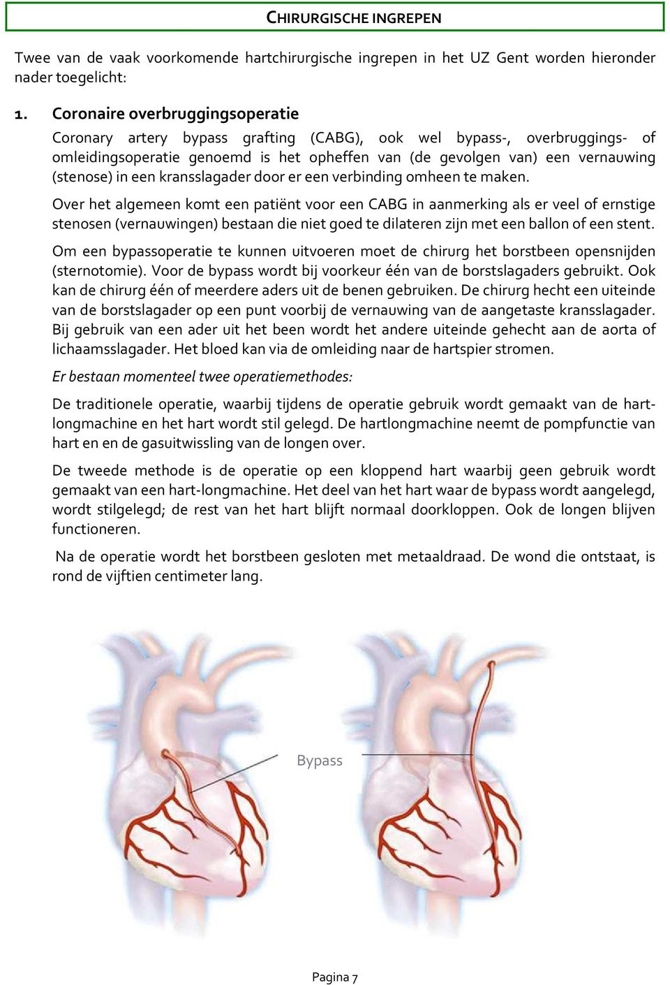 een kransslagader door er een verbinding omheen te maken.