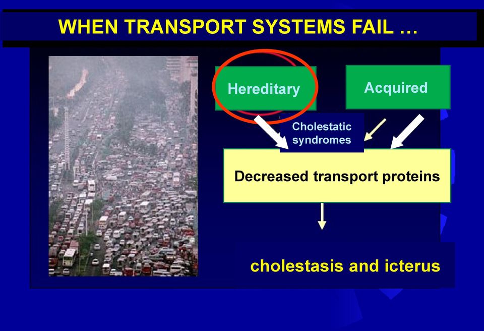 Cholestatic syndromes