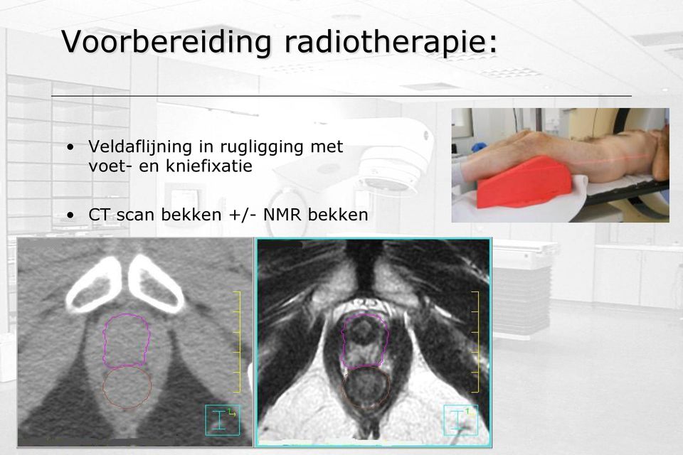 Veldaflijning in rugligging