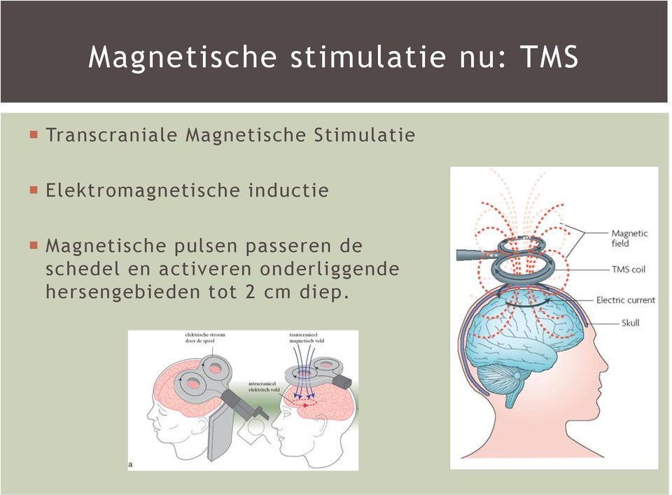 inductie Magnetische pulsen passeren de schedel