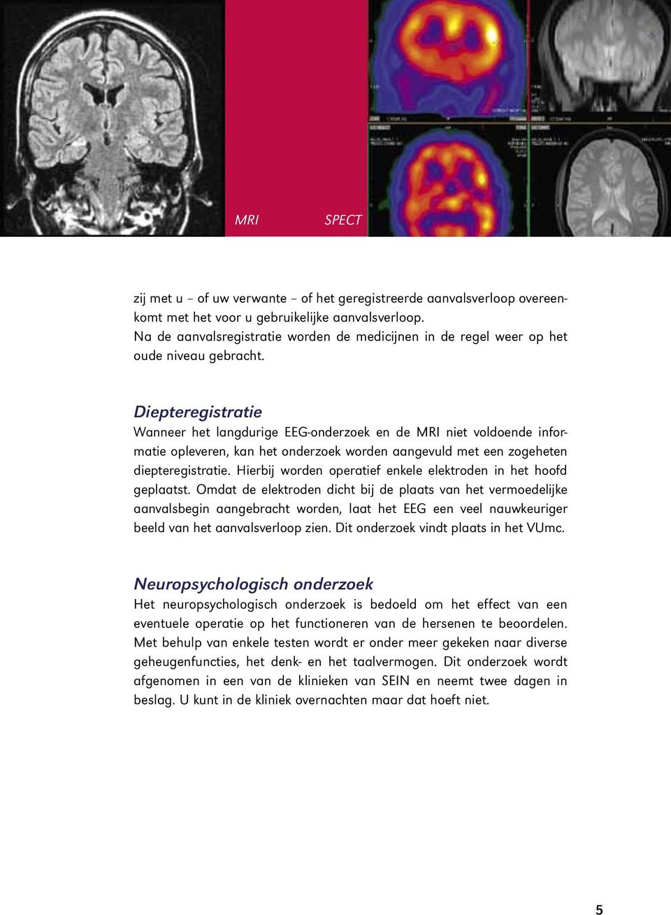 Diepteregistratie Wanneer het langdurige EEG-onderzoek en de MRI niet voldoende informatie opleveren, kan het onderzoek worden aangevuld met een zogeheten diepteregistratie.