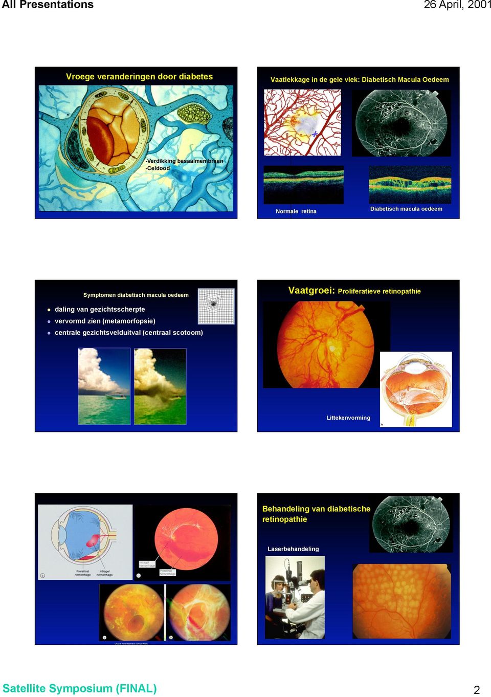 macula oedeem daling van gezichtsscherpte vervormd zien (metamorfopsie) centrale gezichtsvelduitval (centraal