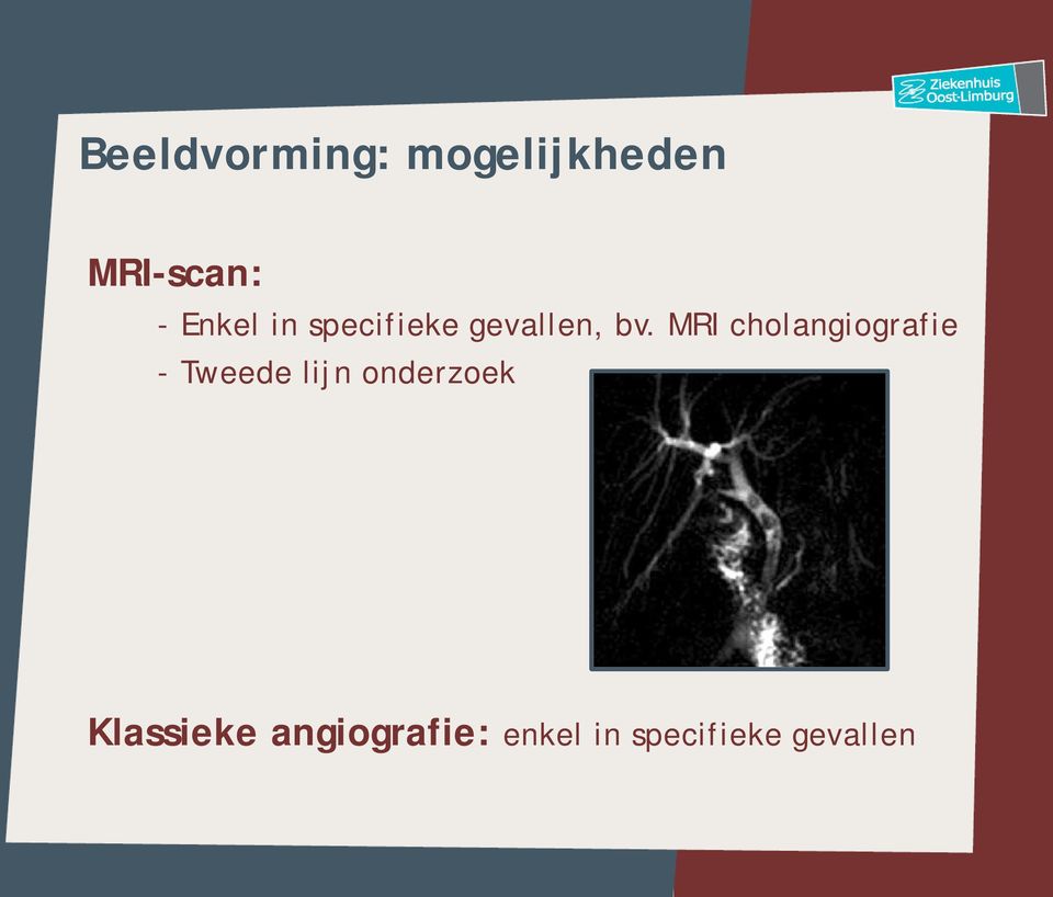 MRI cholangiografie - Tweede lijn