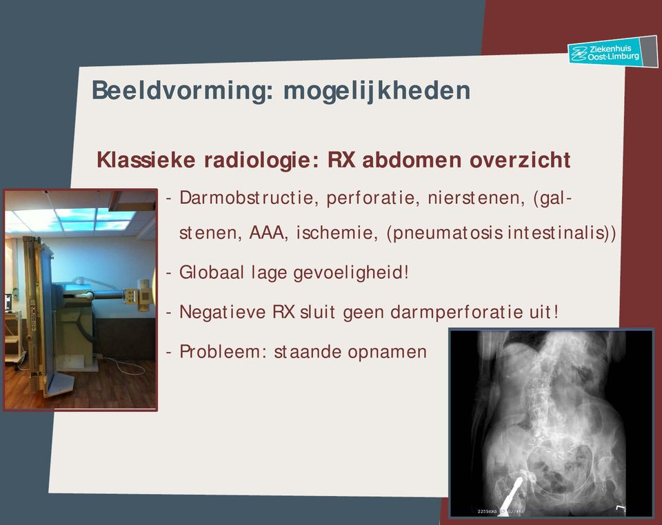 AAA, ischemie, (pneumatosis intestinalis)) - Globaal lage