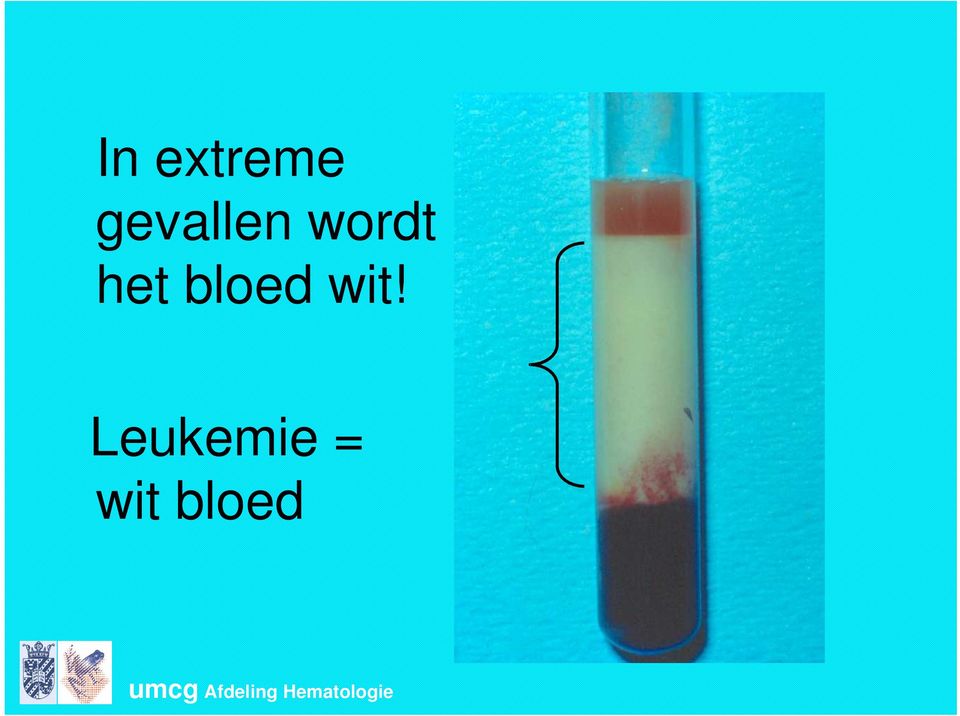 Leukemie = wit bloed