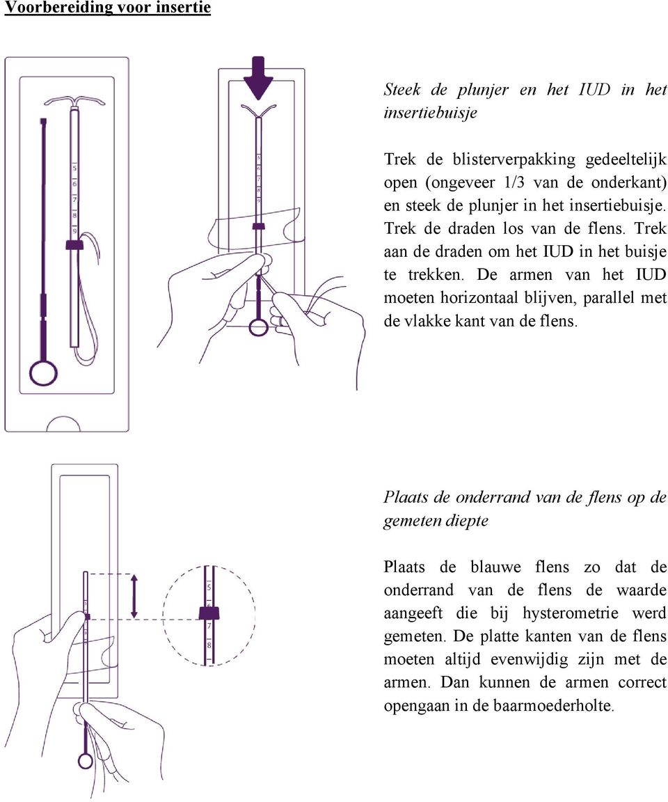 De armen van het IUD moeten horizontaal blijven, parallel met de vlakke kant van de flens.