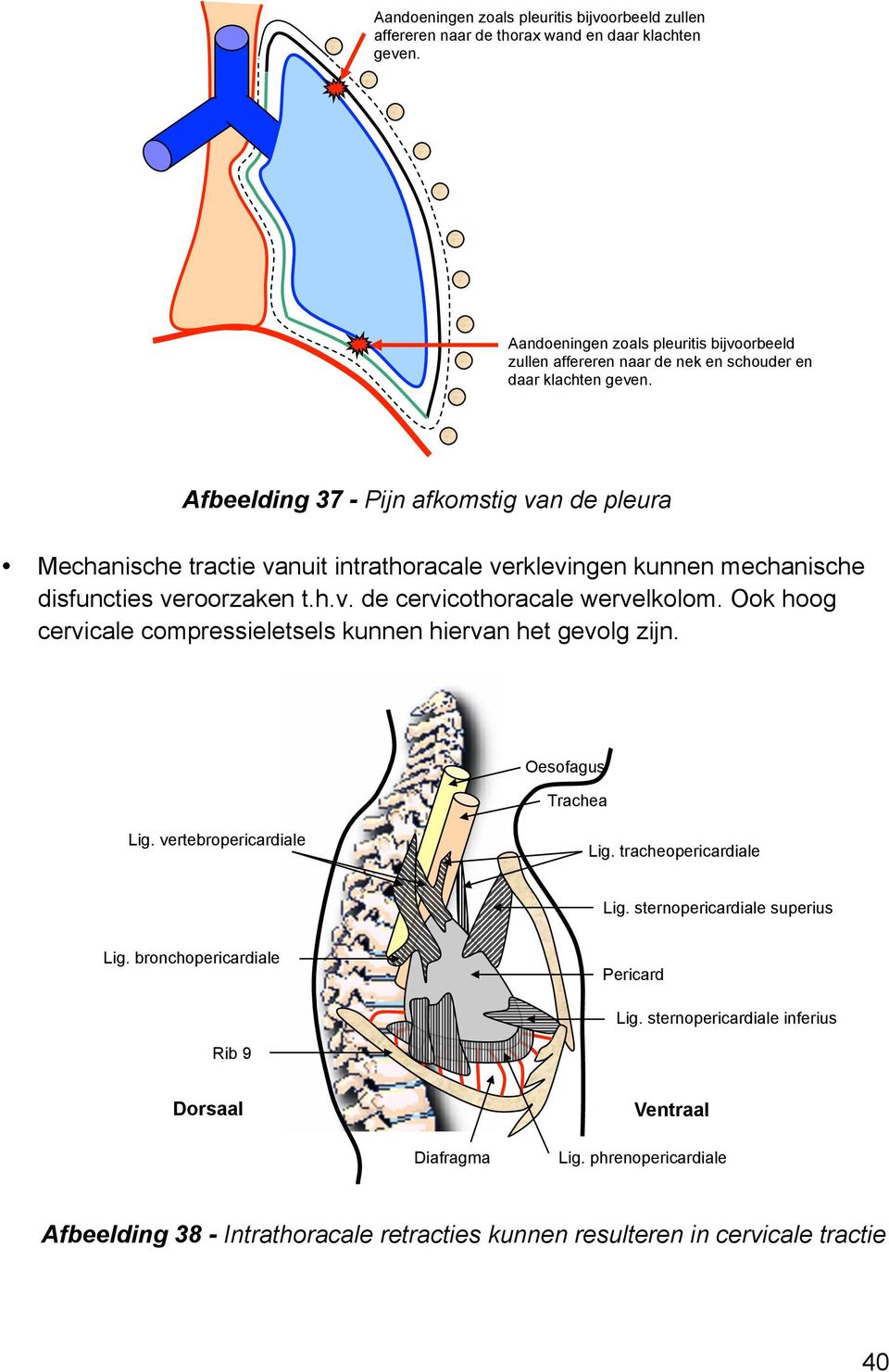 Afbeelding 37 - Pijn afkomstig van de pleura Mechanische tractie vanuit intrathoracale verklevingen kunnen mechanische disfuncties veroorzaken t.h.v. de cervicothoracale wervelkolom.