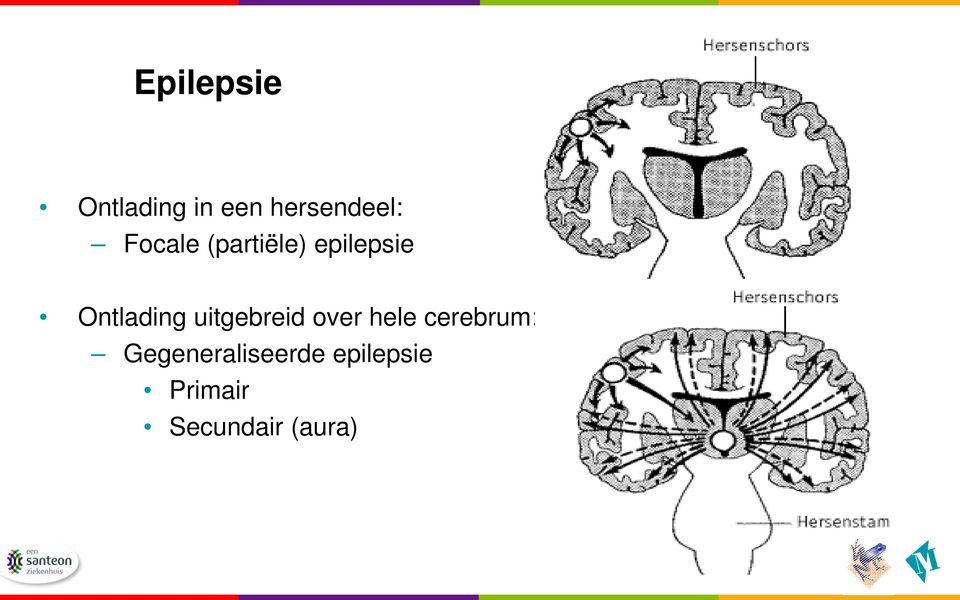 uitgebreid over hele cerebrum: