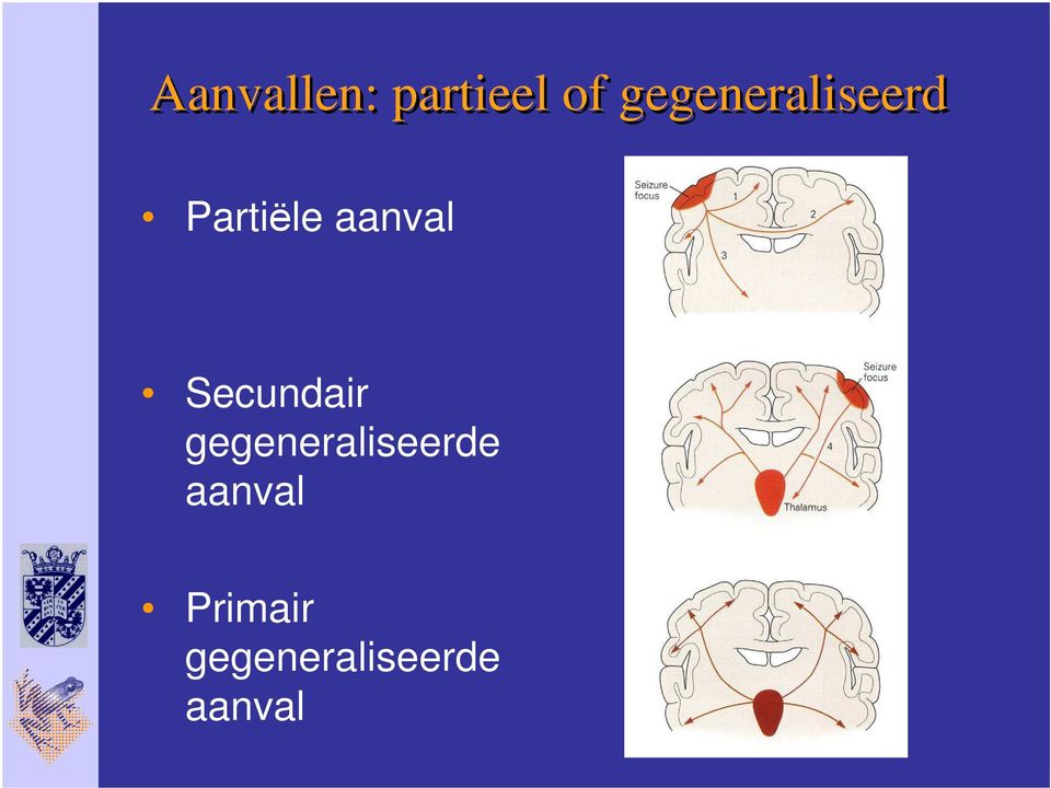 aanval Secundair