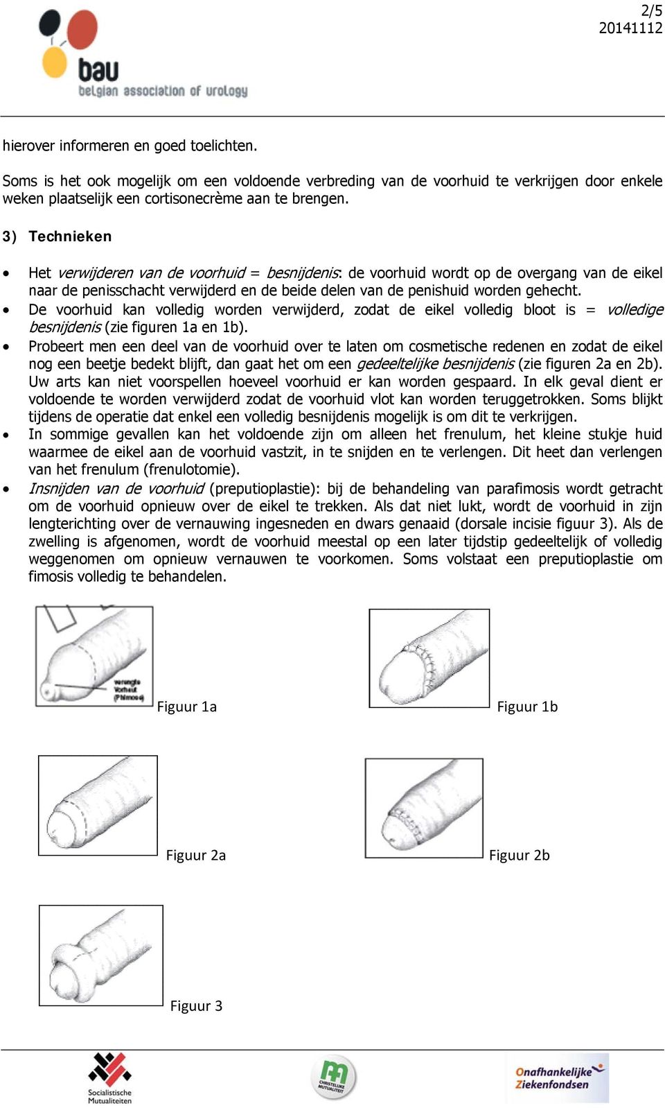 De voorhuid kan volledig worden verwijderd, zodat de eikel volledig bloot is = volledige besnijdenis (zie figuren 1a en 1b).