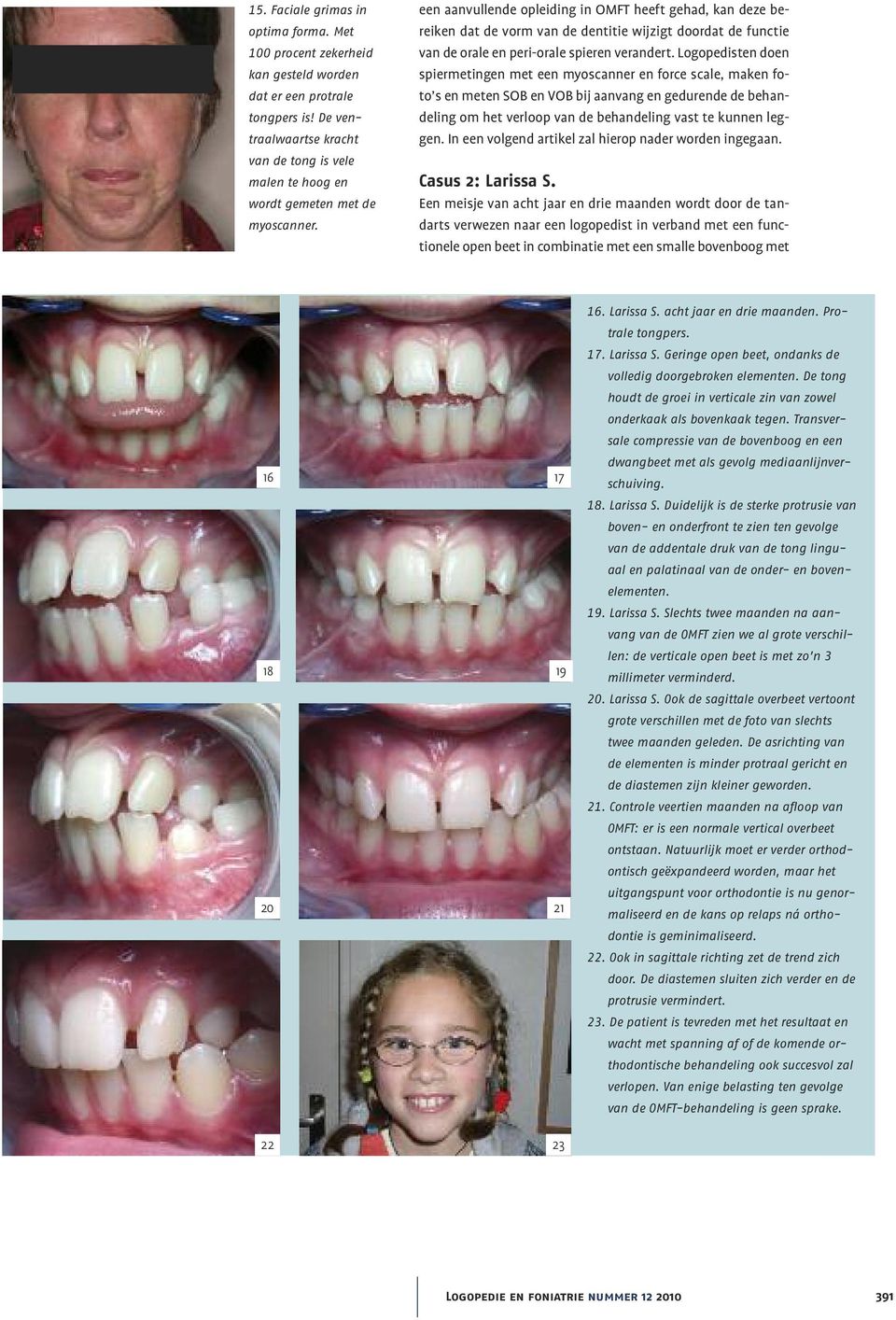een aanvullende opleiding in OMFT heeft gehad, kan deze bereiken dat de vorm van de dentitie wijzigt doordat de functie van de orale en peri-orale spieren verandert.