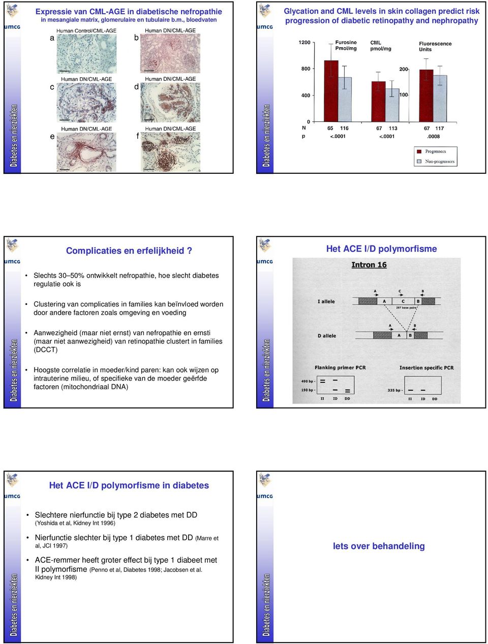 Het ACE I/D polymorfisme Slechts 3 5% ontwikkelt nefropathie, hoe slecht diabetes regulatie ook is Clustering van complicaties in families kan beïnvloed worden door andere factoren zoals omgeving en