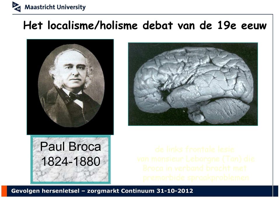 lesie van monsieur Leborgne (Tan) die Broca