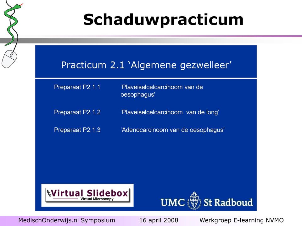 Plaveiselcelcarcinoom van de oesophagus Preparaat