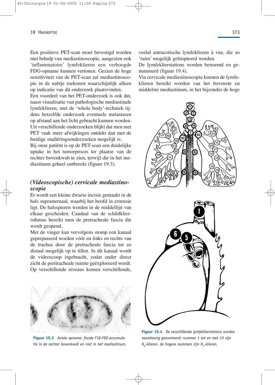 Een voordeel van het PET-onderzoek is ook dat, naast visualisatie van pathologische mediastinale lymfeklieren, met de whole body -techniek tijdens hetzelfde onderzoek eventuele metastasen op afstand