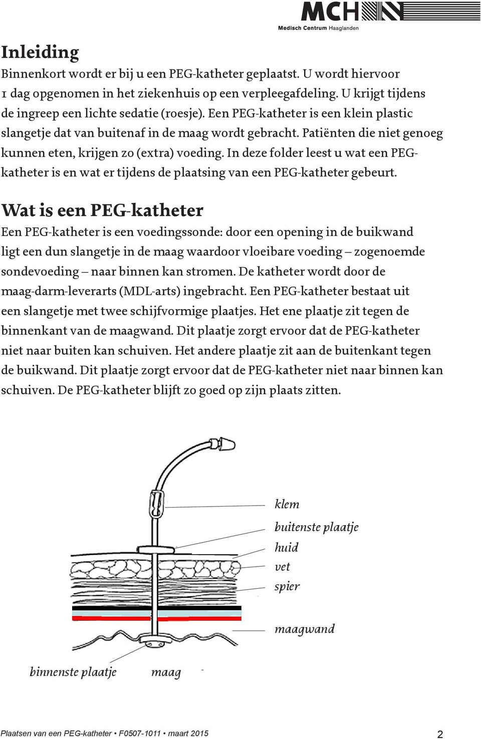 In deze folder leest u wat een PEGkatheter is en wat er tijdens de plaatsing van een PEG-katheter gebeurt.