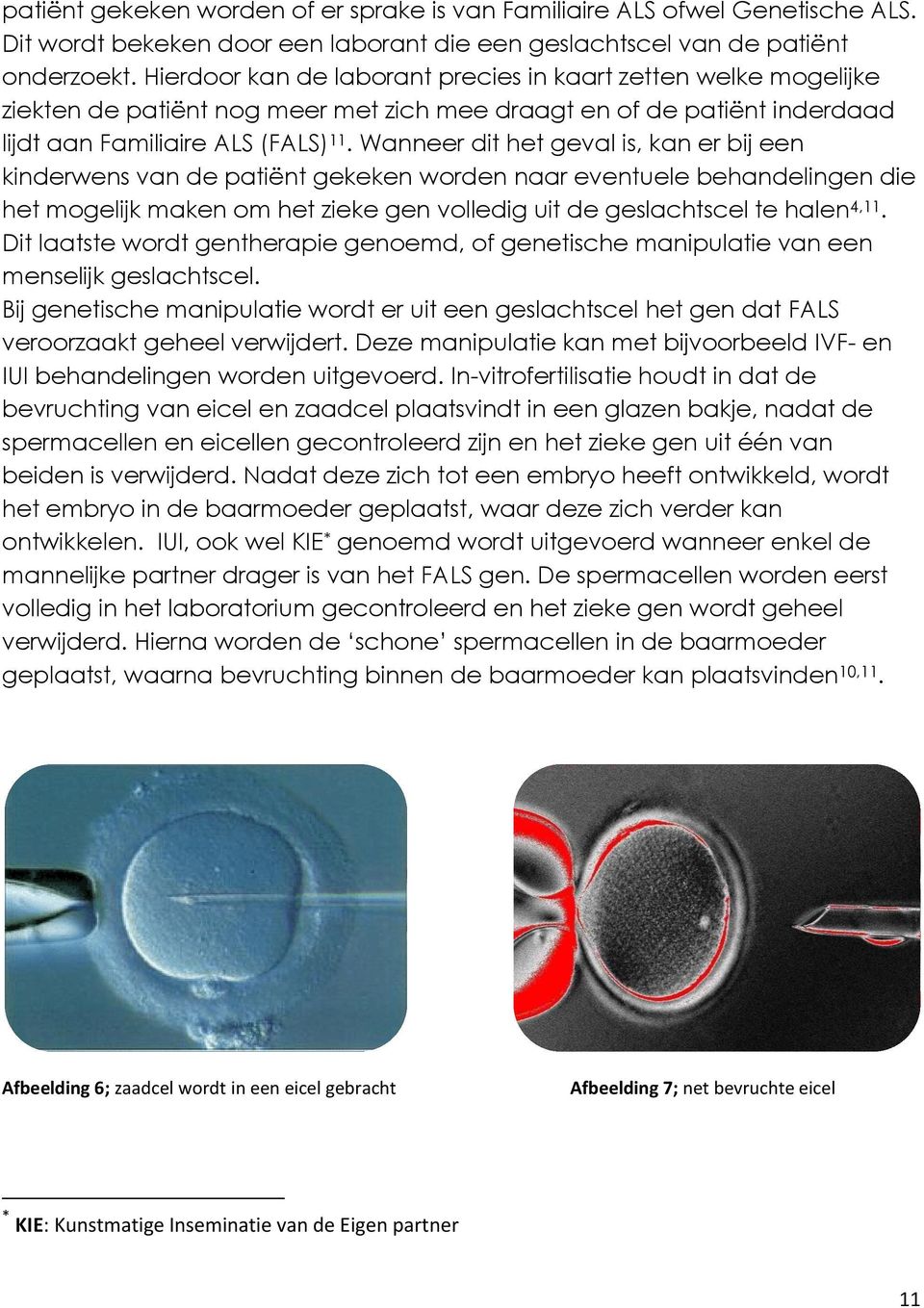 Wanneer dit het geval is, kan er bij een kinderwens van de patiënt gekeken worden naar eventuele behandelingen die het mogelijk maken om het zieke gen volledig uit de geslachtscel te halen 4,11.