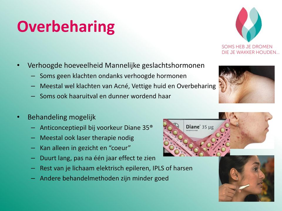 Anticonceptiepil bij voorkeur Diane 35 Meestal ook laser therapie nodig Kan alleen in gezicht en coeur Duurt lang, pas