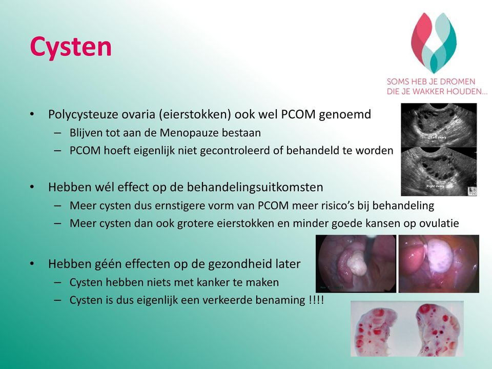 van PCOM meer risico s bij behandeling Meer cysten dan ook grotere eierstokken en minder goede kansen op ovulatie Hebben