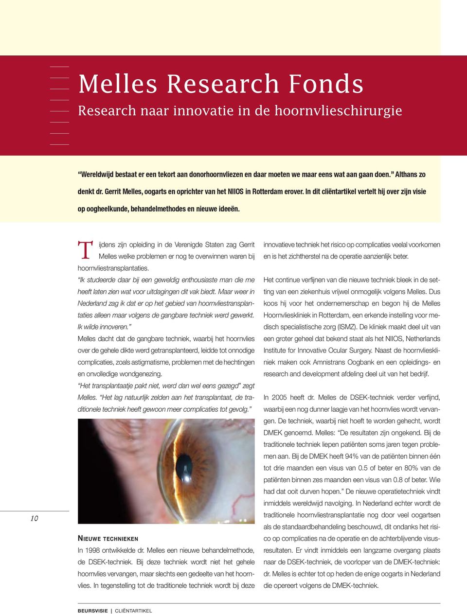 10 T ijdens zijn opleiding in de Verenigde Staten zag Gerrit Melles welke problemen er nog te overwinnen waren bij hoornvliestransplantaties.