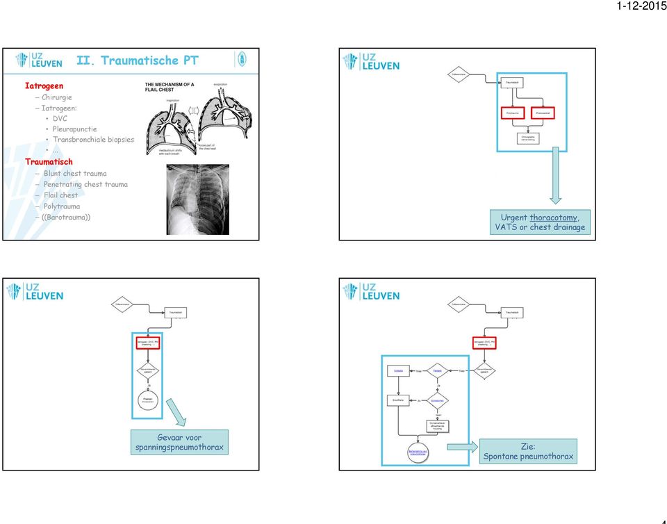 .. Traumatisch Blunt chest trauma Penetrating chest trauma Flail
