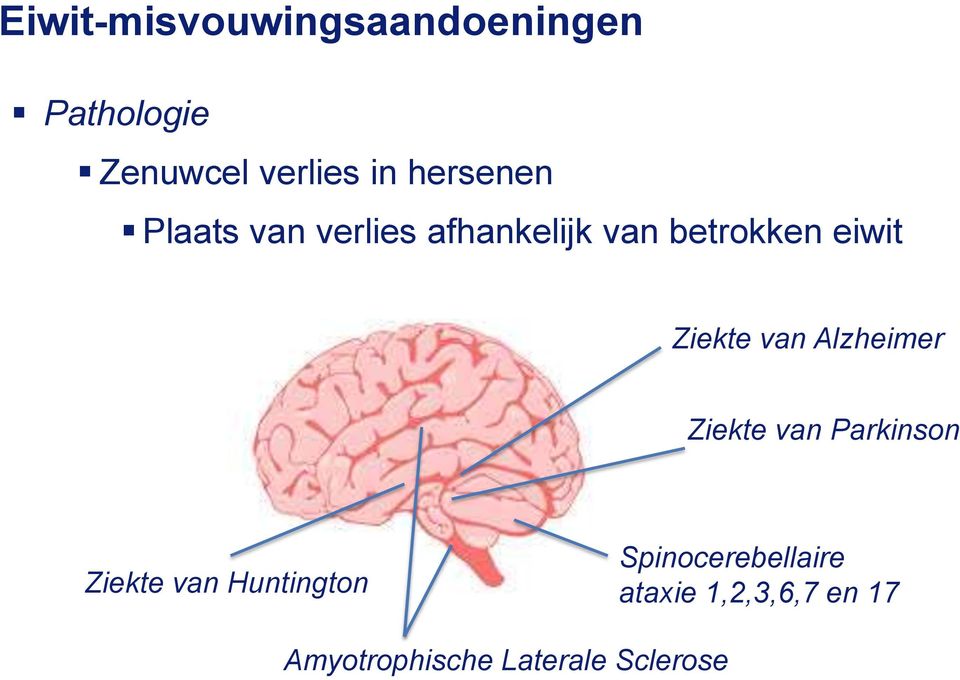 Ziekte van Alzheimer Ziekte van Parkinson Ziekte van Huntington