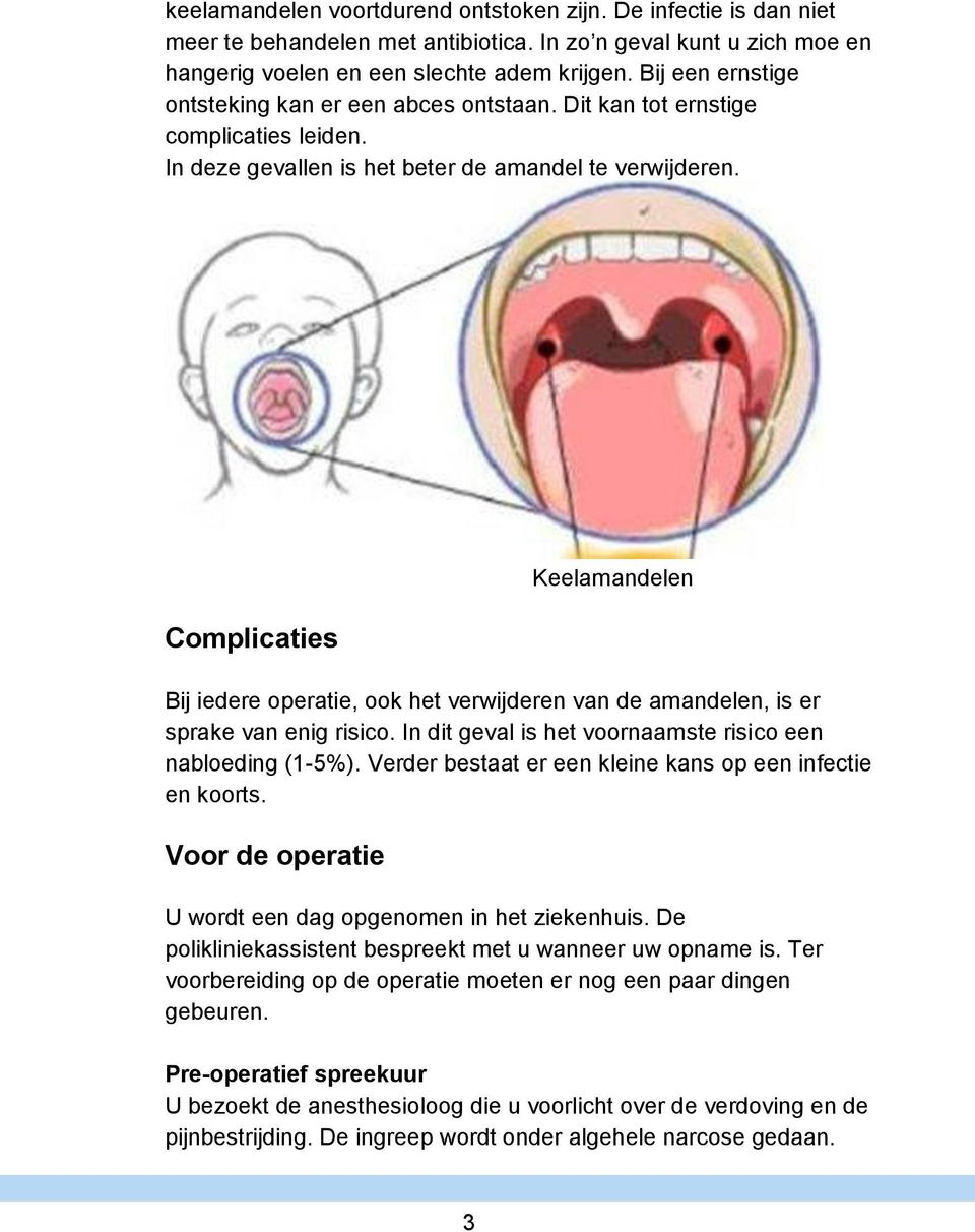 Complicaties Keelamandelen Bij iedere operatie, ook het verwijderen van de amandelen, is er sprake van enig risico. In dit geval is het voornaamste risico een nabloeding (1-5%).