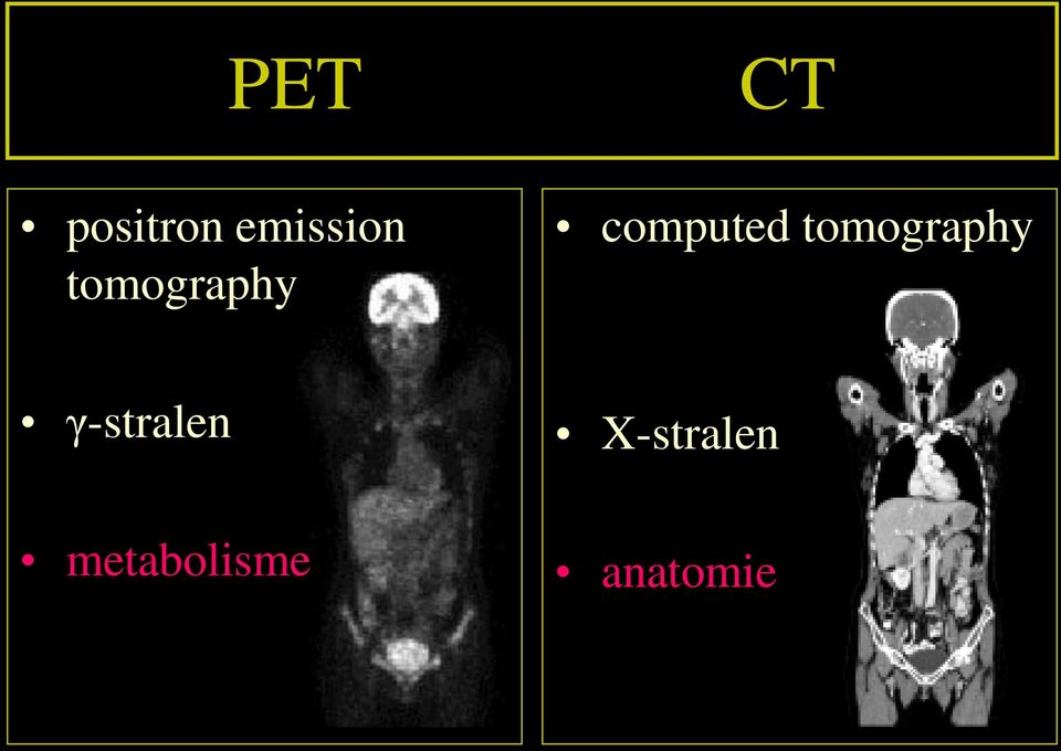 computed tomography