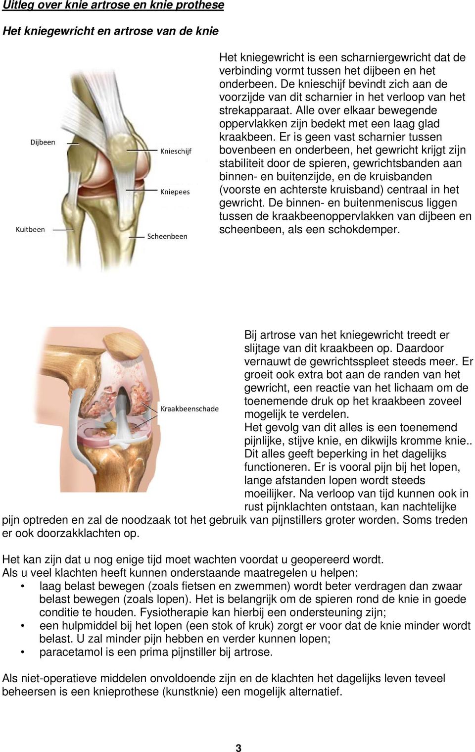 Er is geen vast scharnier tussen bovenbeen en onderbeen, het gewricht krijgt zijn stabiliteit door de spieren, gewrichtsbanden aan binnen- en buitenzijde, en de kruisbanden (voorste en achterste