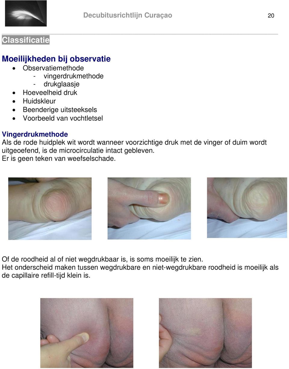 vinger of duim wordt uitgeoefend, is de microcirculatie intact gebleven. Er is geen teken van weefselschade.