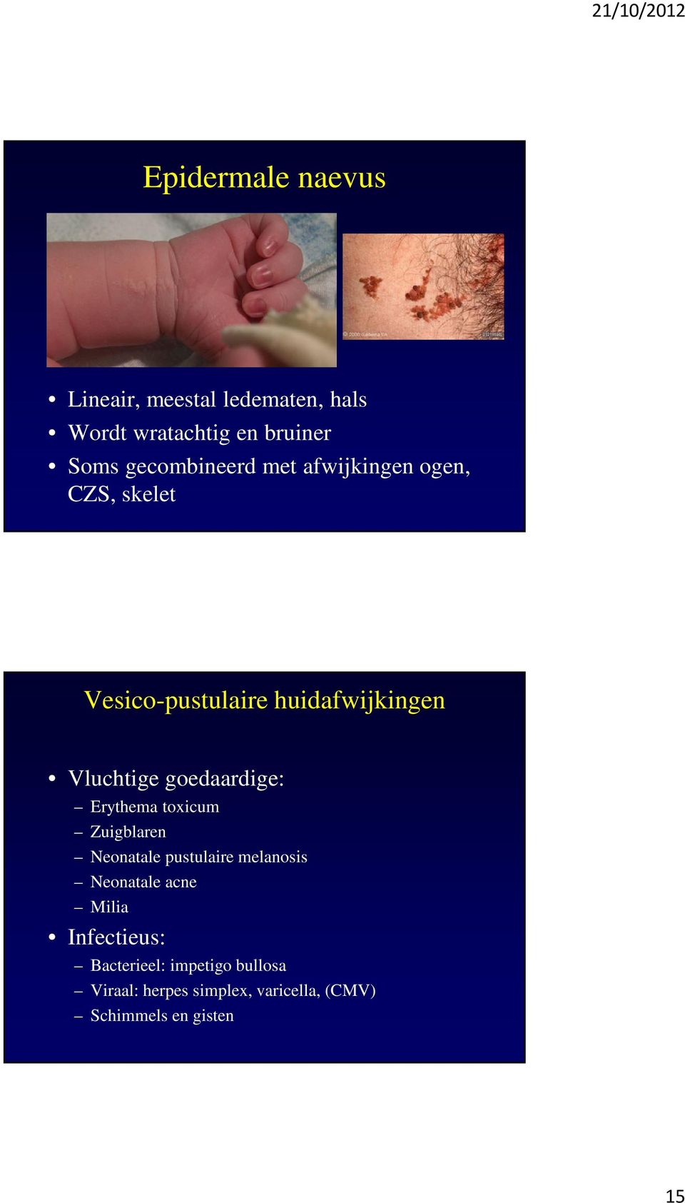 goedaardige: Erythema toxicum Zuigblaren Neonatale pustulaire melanosis Neonatale acne Milia