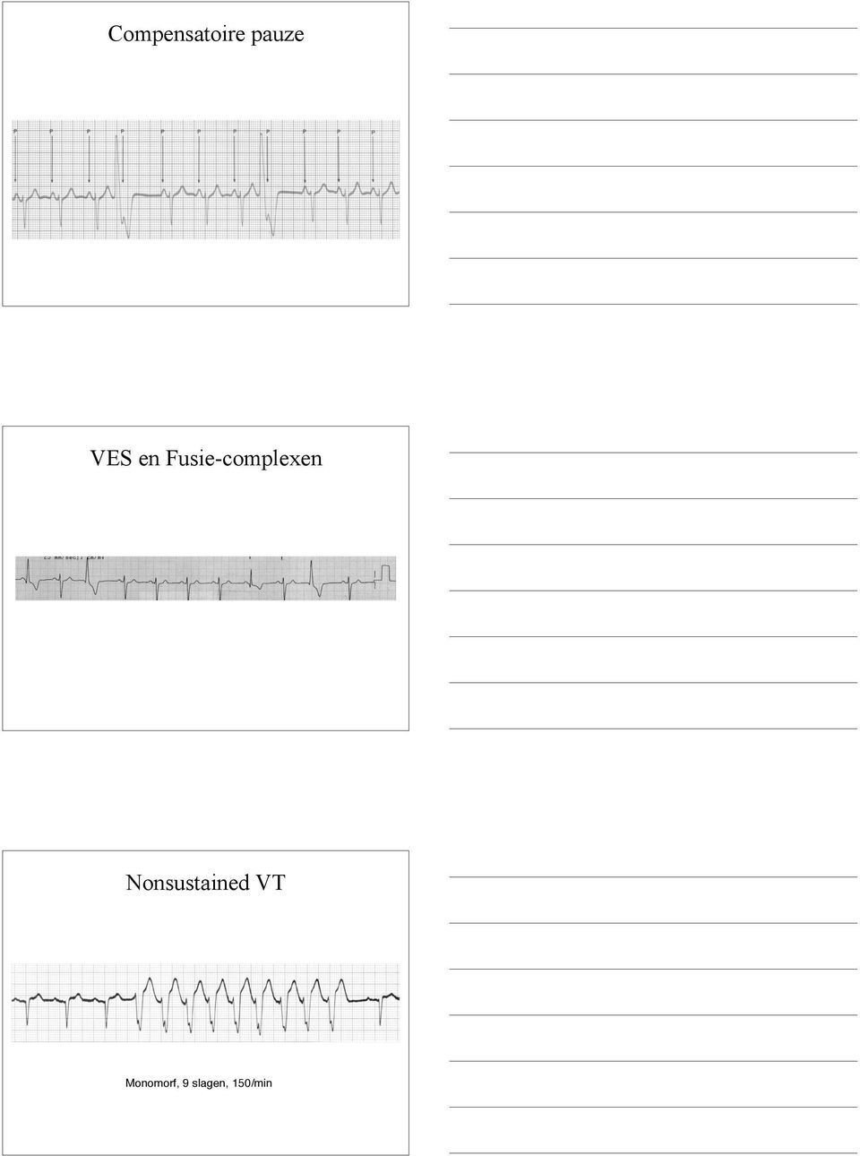 Fusie-complexen