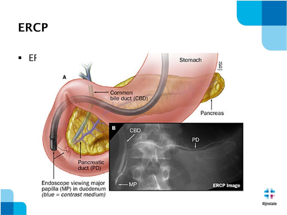 ductus