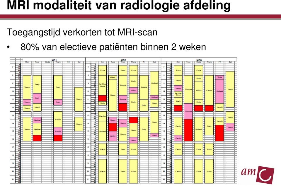 verkorten tot MRI-scan 80%