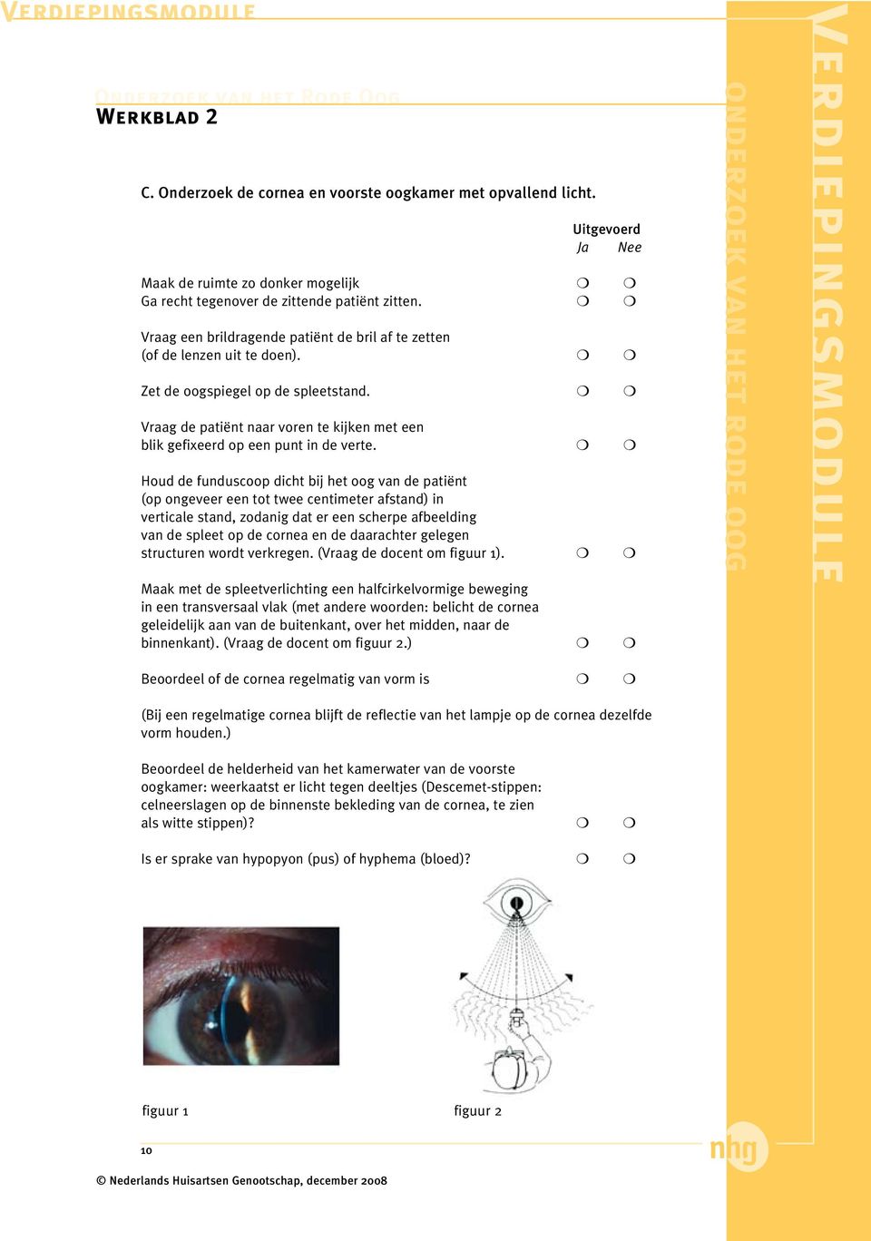 Houd de funduscoop dicht bij het oog van de patiënt (op ongeveer een tot twee centimeter afstand) in verticale stand, zodanig dat er een scherpe afbeelding van de spleet op de cornea en de daarachter