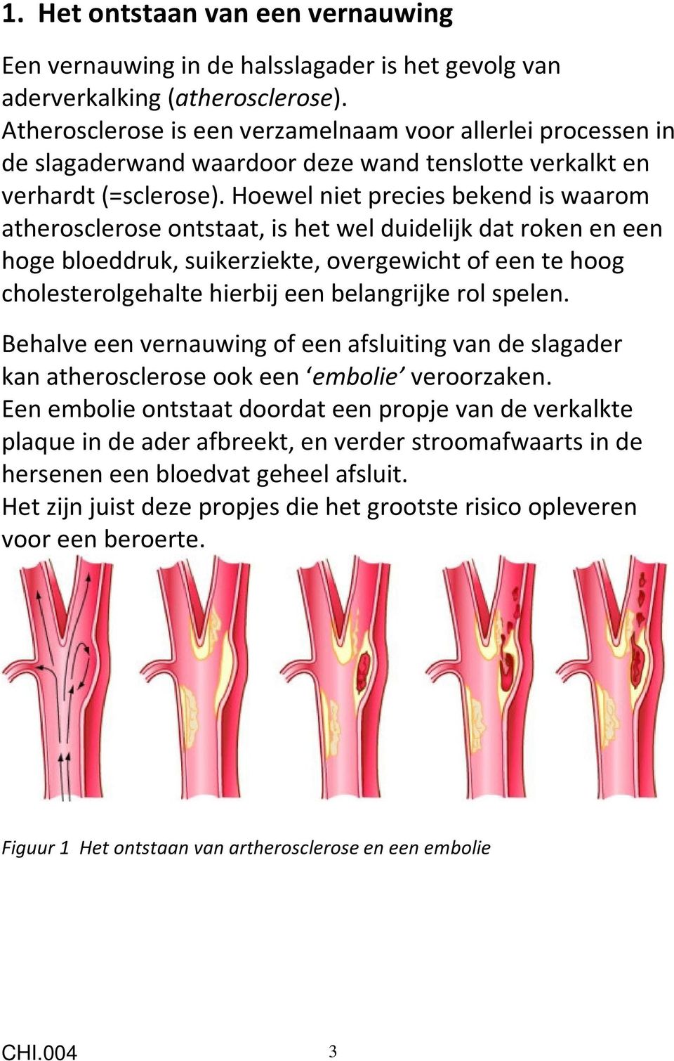 Hoewel niet precies bekend is waarom atherosclerose ontstaat, is het wel duidelijk dat roken en een hoge bloeddruk, suikerziekte, overgewicht of een te hoog cholesterolgehalte hierbij een belangrijke