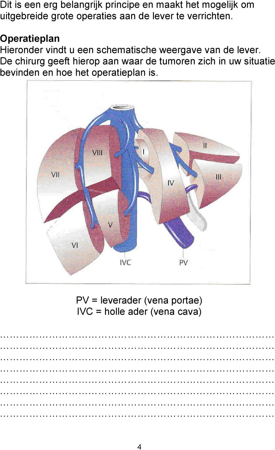 Operatieplan Hieronder vindt u een schematische weergave van de lever.