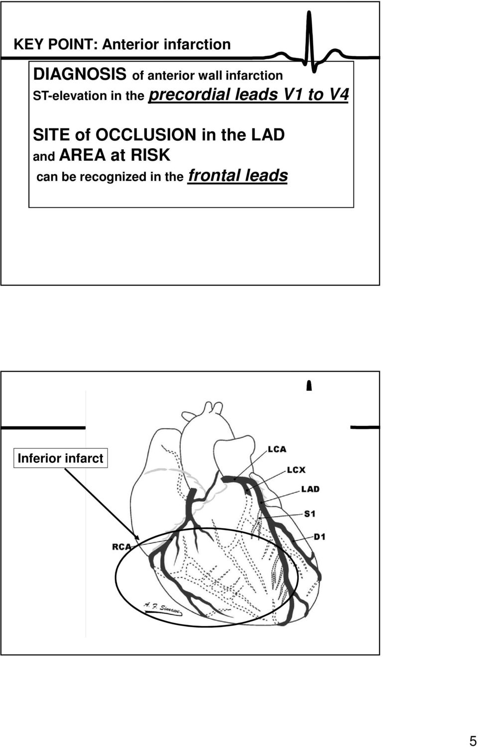 V1 to V4 SITE of OCCLUSION in the LAD and AREA at RISK