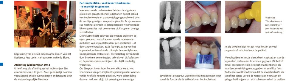 Zoals gebruikelijk daaraan voorafgaand enkele overwegingen ondersteund door Peri-implantitis,- veel liever voorkomen, - is moeilijk te genezen Vooraanstaande onderzoekers hebben de afgelopen jaren in