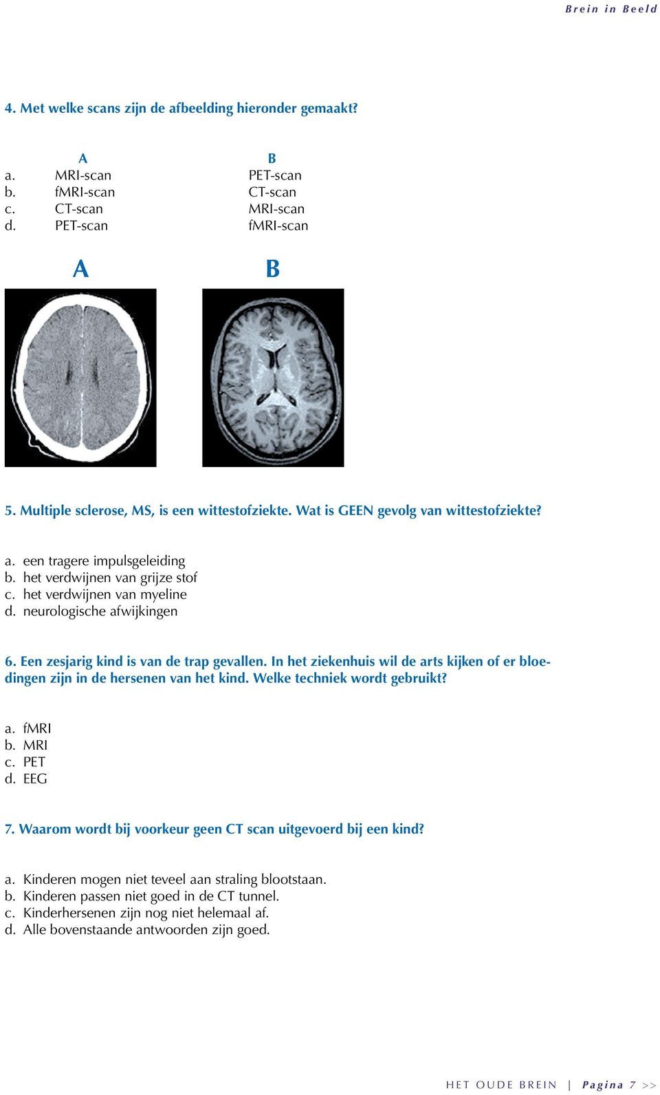 Een zesjarig kind is van de trap gevallen. In het ziekenhuis wil de arts kijken of er bloedingen zijn in de hersenen van het kind. Welke techniek wordt gebruikt? a. fmri b. MRI c. PET d. EEG 7.