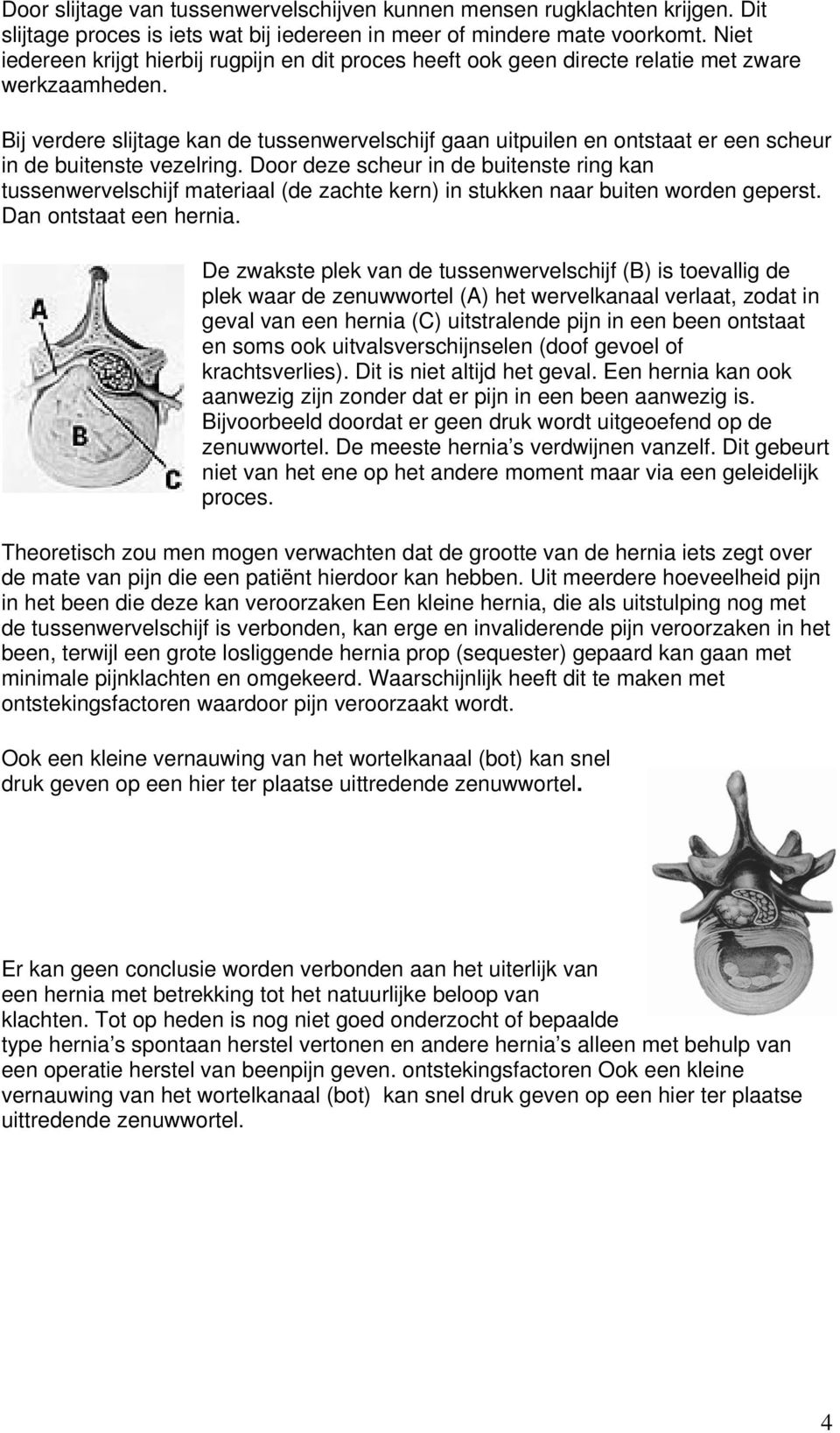 Bij verdere slijtage kan de tussenwervelschijf gaan uitpuilen en ontstaat er een scheur in de buitenste vezelring.