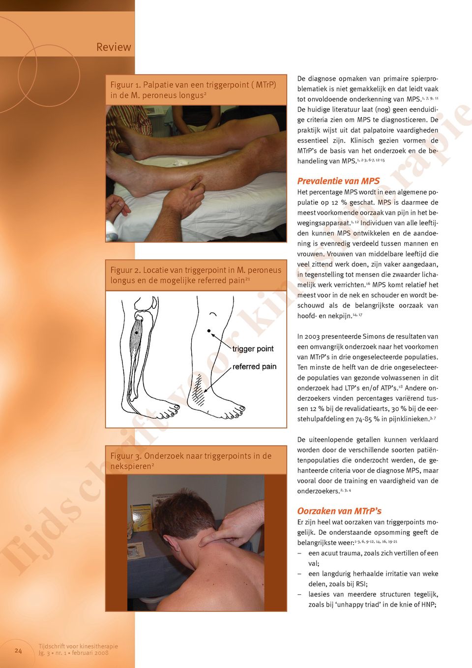 Klinisch gezien vormen de MTrP s de basis van het onderzoek en de behandeling van MPS.1, 2-3, 6-7, 12-15 ra pi e Figuur 1. Palpatie van een triggerpoint ( MTrP) in de M.