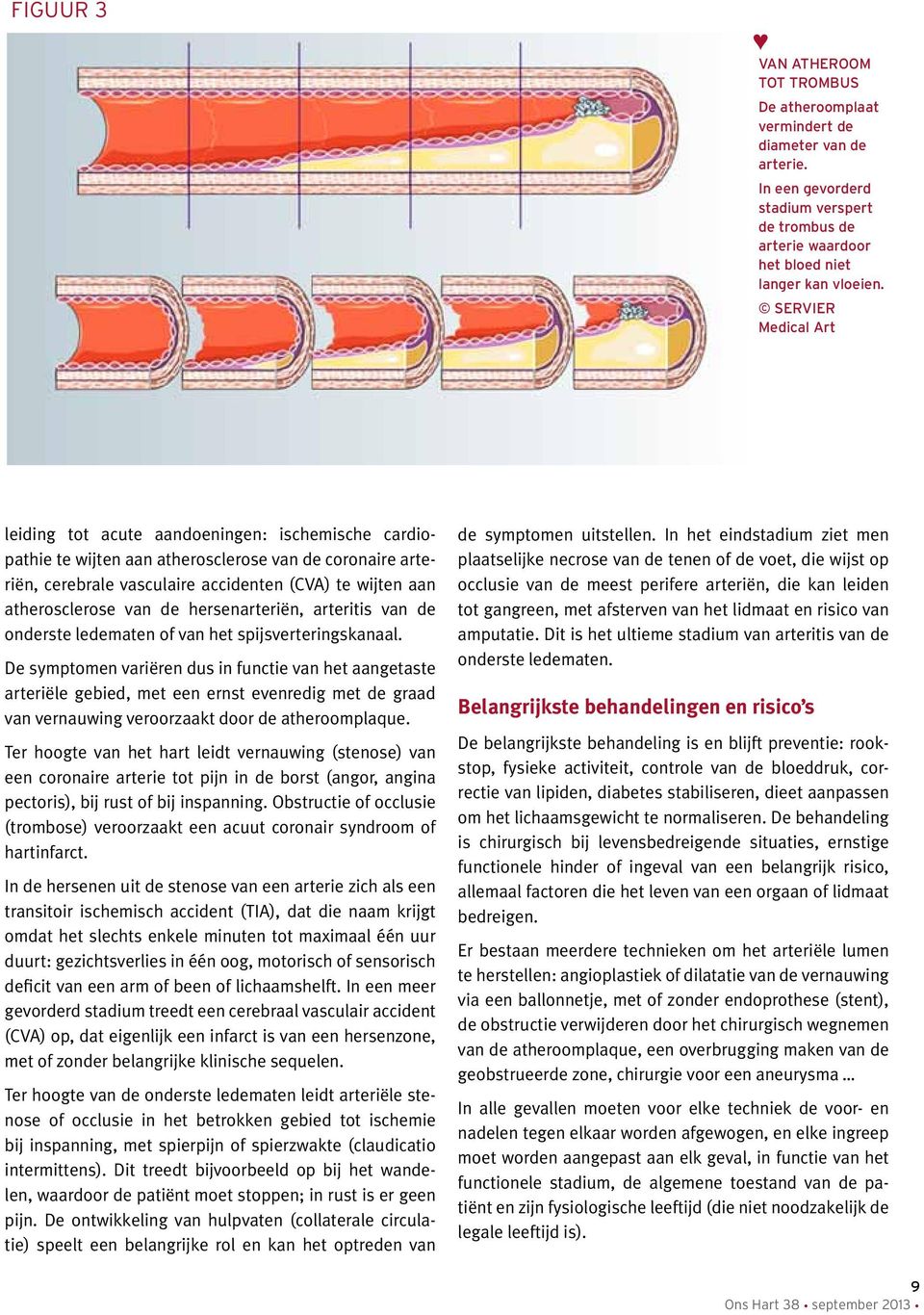 van de hersenarteriën, arteritis van de onderste ledematen of van het spijsverteringskanaal.