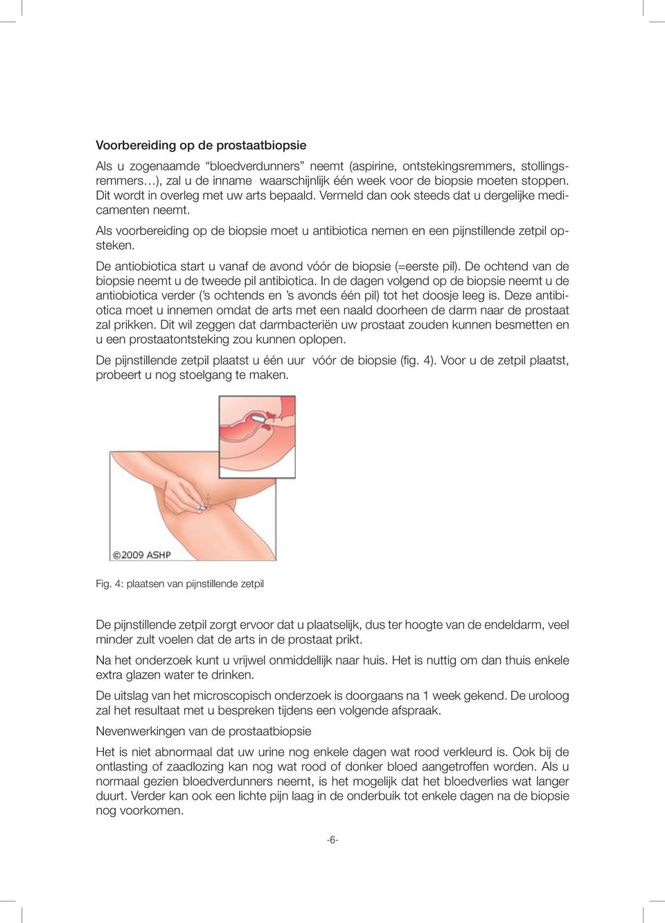 De antiobiotica start u vanaf de avond vóór de biopsie (=eerste pil). De ochtend van de biopsie neemt u de tweede pil antibiotica.