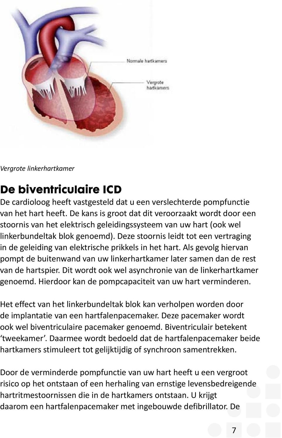 Deze stoornis leidt tot een vertraging in de geleiding van elektrische prikkels in het hart. Als gevolg hiervan pompt de buitenwand van uw linkerhartkamer later samen dan de rest van de hartspier.