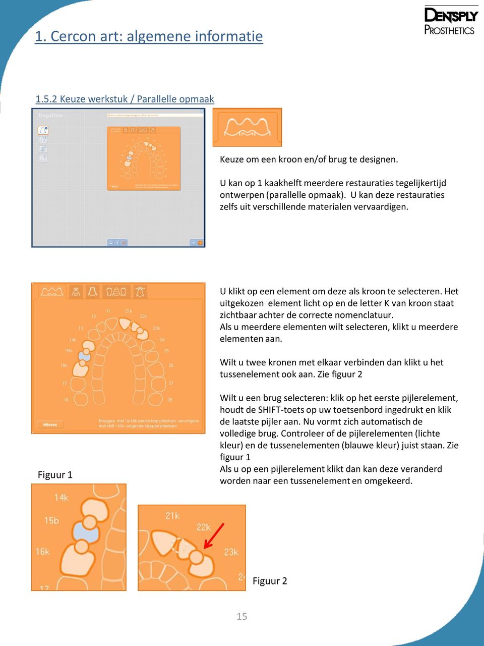 U klikt op een element om deze als kroon te selecteren. Het uitgekozen element licht op en de letter K van kroon staat zichtbaar achter de correcte nomenclatuur.